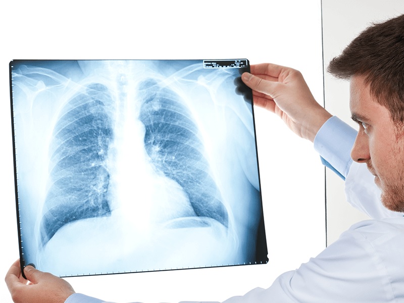 Rayos x pys gestion integral